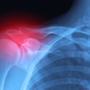 Musculoskeletal Injuries, Maritime Workers